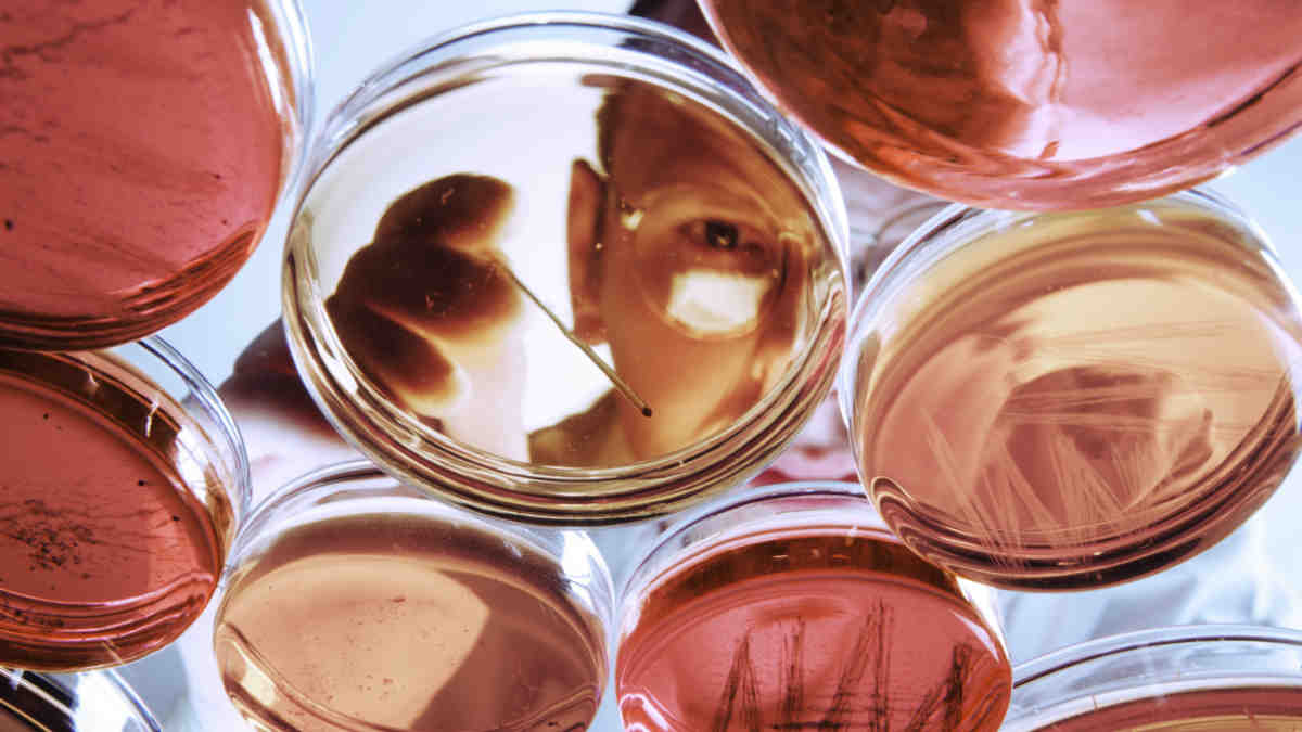 As AI rewires microbiology, Clever Culture’s...